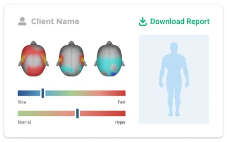 Image of a brain map report for a client.