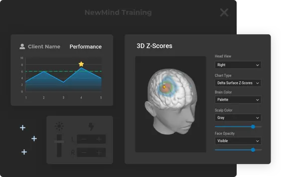 Image of screenshot of a Neurofeedback Report