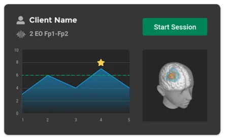 An image of Neurofeedback Report