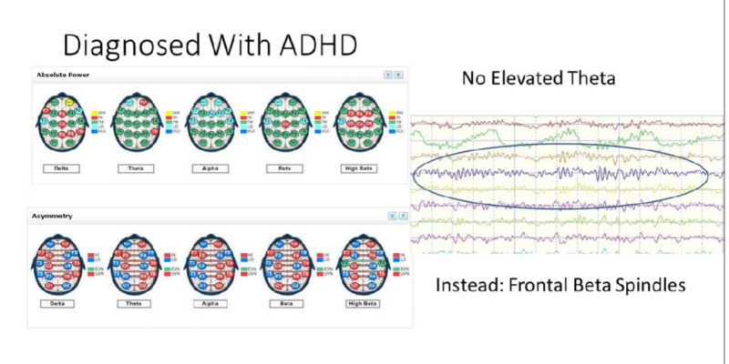 Different Brainwaves and Theta’s Role in Memory and Relaxation ...
